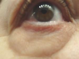bella pre eye1 Bella Semplice masks make you look so “bella”