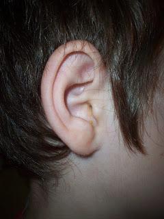 Ear Lobes