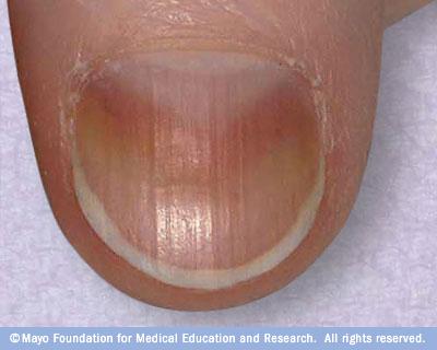 Nails grow from the area at the base of the nail under your cuticle