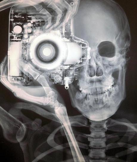 eXquisite X-rays