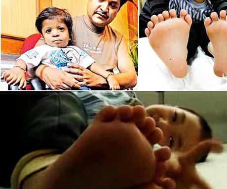 Amazing Baby Born With 34 Fingers - New World Record Amazing Baby Born With 34 Fingers - New World Record title post 0