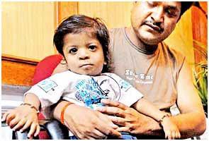 Amazing Baby Born With 34 Fingers - New World Record Amazing Baby Born With 34 Fingers - New World Record 1