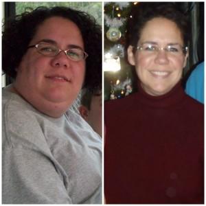Marlee’s Before and After Gastric Sleeve Surgery Photos & Story