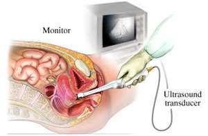 Is a transvaginal ultrasound really that intrusive? Evil, intrusive medical device