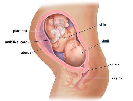 Woman dies during 33-week abortion A baby at 33 weeks.