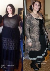 Leslie - Before and After Gastric Sleeve Surgery Photos