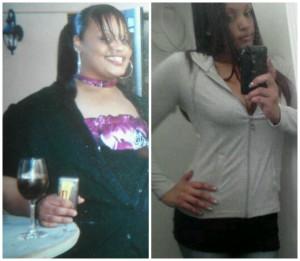 Before and After Gastric Bypass Photos & Story 