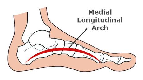 The Mighty Arch: A Natural Cure for Plantar Fasciitis? Medial Longitudinal Arch