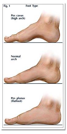Foot Problems and What Can Be Done