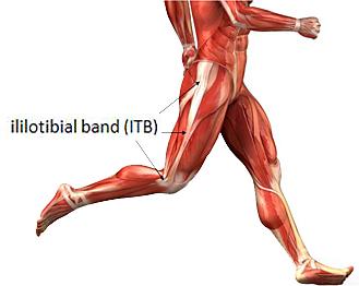 Treatment for IT Band Syndrome (Runner’s Knee)