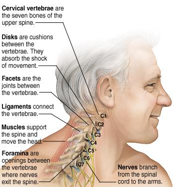A Pain in the Neck:  What To Do About Neck Pain