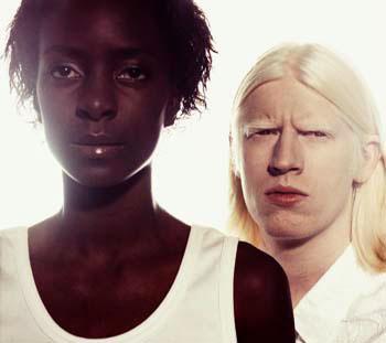 A Whiter Shade of Pale - Albino models take to the runways