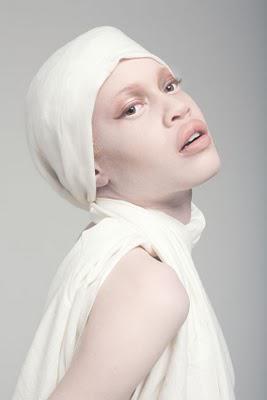 A Whiter Shade of Pale - Albino models take to the runways