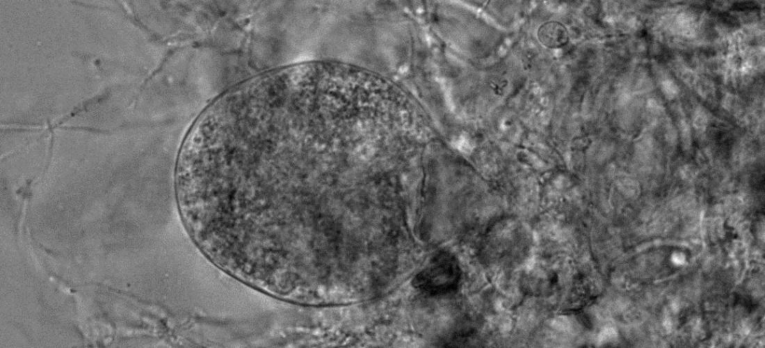 Fungi Will Help Chemists to Streamline Biofuel Production An anaerobic gut fungus from the digestive tract of a horse. (Credit: John K. Henske)