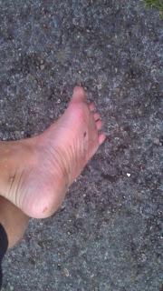 Barefoot Running? Yeah, I do that.