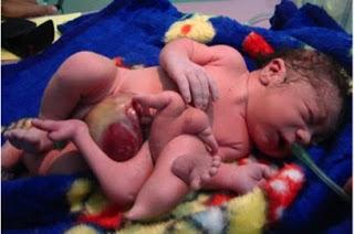 Toxic US Weapons Blamed For Iraq's Birth Defects (Video)