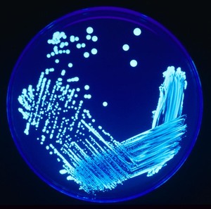Legionella sp. colonies growing on an agar pla...