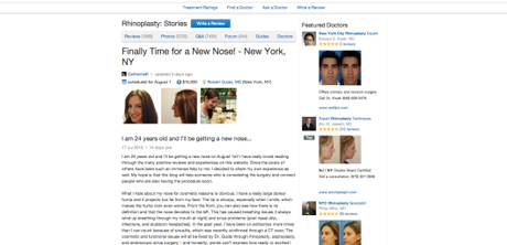 Finally Time for a New Nose! - New York, NY - Rhinoplasty review - RealSelf