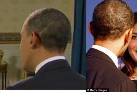 Obama's scar left & right What Reggie Love said about Obama’s birth certificate