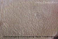 Treatment Products – Pimples! Treatment Products – Pimples!