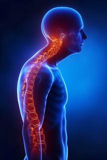 Friday Q&A: Kyphosis (Dowager's Hump) Friday Q&A: Kyphosis (Dowager's Hump)