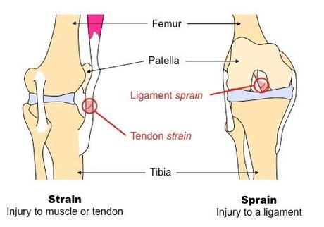 strain vs sprain