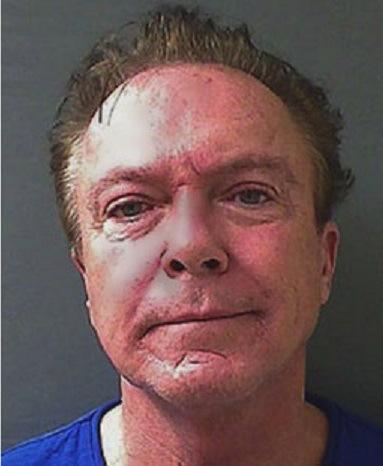 What a life of alcoholism does to David Cassidy davidcassidy2013