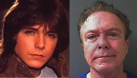 What a life of alcoholism does to David Cassidy davidcassidy2013