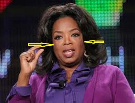 What’s with those strange lines on Oprah’s face? Oprah