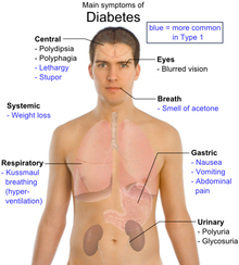 Main symptoms of diabetes