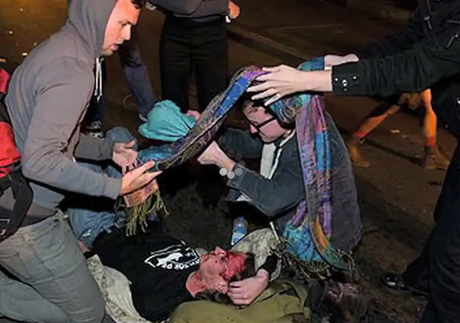Occupy Oakland protestor Scott Olsen’s skull fractured during police crack-down, OWS responds