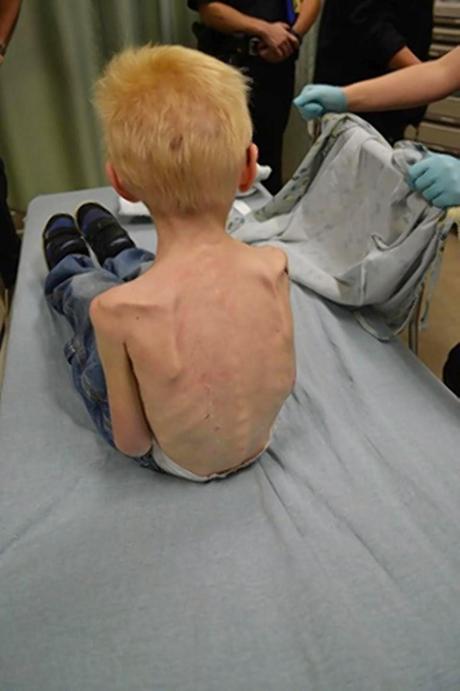 5 Yr Old Starved, Locked in Closet, Skin Peeling And In A Diaper (Disturbing Video)