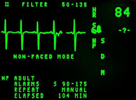 electrocardiogram-16948_1920