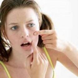 Natural Ideas To Get Rid of Acne Scars Acne Scars Tips