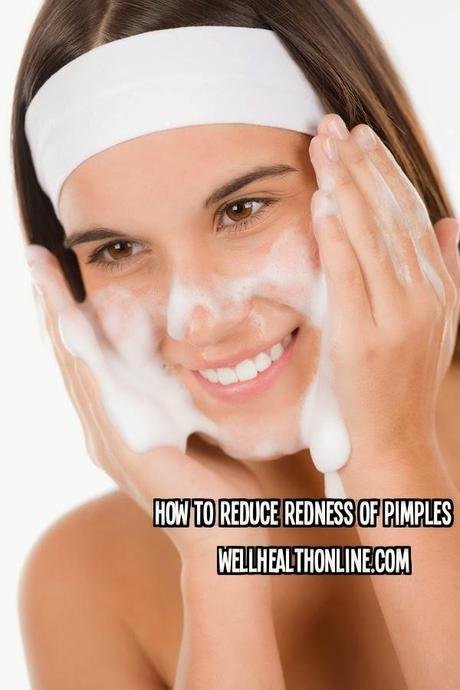 How To Reduce Redness Of Pimples