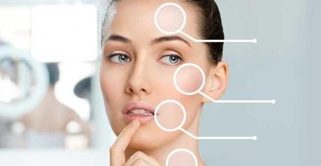 Facial Implants Facial Implants