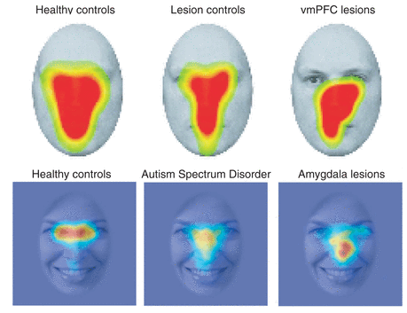 Social attention and our ventromedial prefrontal cortex. Social attention and our ventromedial prefrontal cortex.