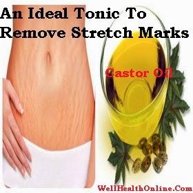 Castor Oil - An Ideal Tonic for Stretch Marks Treatment