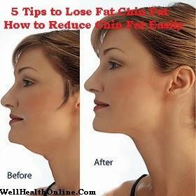 5 Tips to Lose Fat Chin - Discover How to Reduce Chin Fat Easily