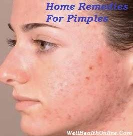 Home Remedies For Pimples