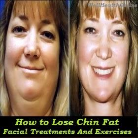 How to lose chin fat