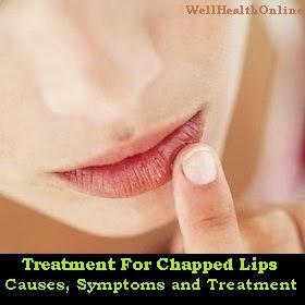 Treatment For Chapped Lips