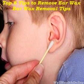 Ear Wax Removal Tips