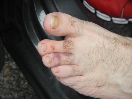 Kenin's toe incident