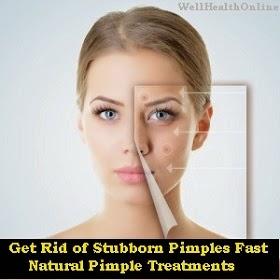 Get Rid of Stubborn Pimples Fast
