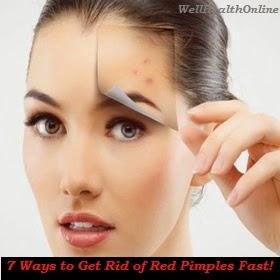 7 Ways to Get Rid of Red Pimples Fast!