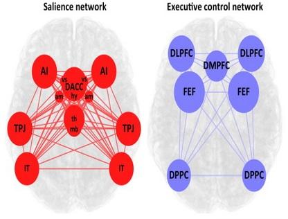 Response of large scale brain networks to acute stress.