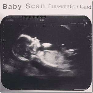 Nemo's First Scan