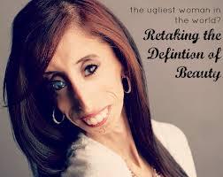 Lizzie Velasquez: The skinniest woman in the world