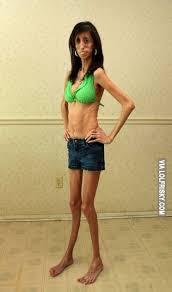 Lizzie Velasquez: The skinniest woman in the world